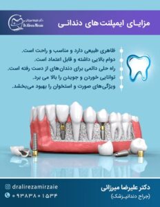 Dental implan Benefits DrM1 1
