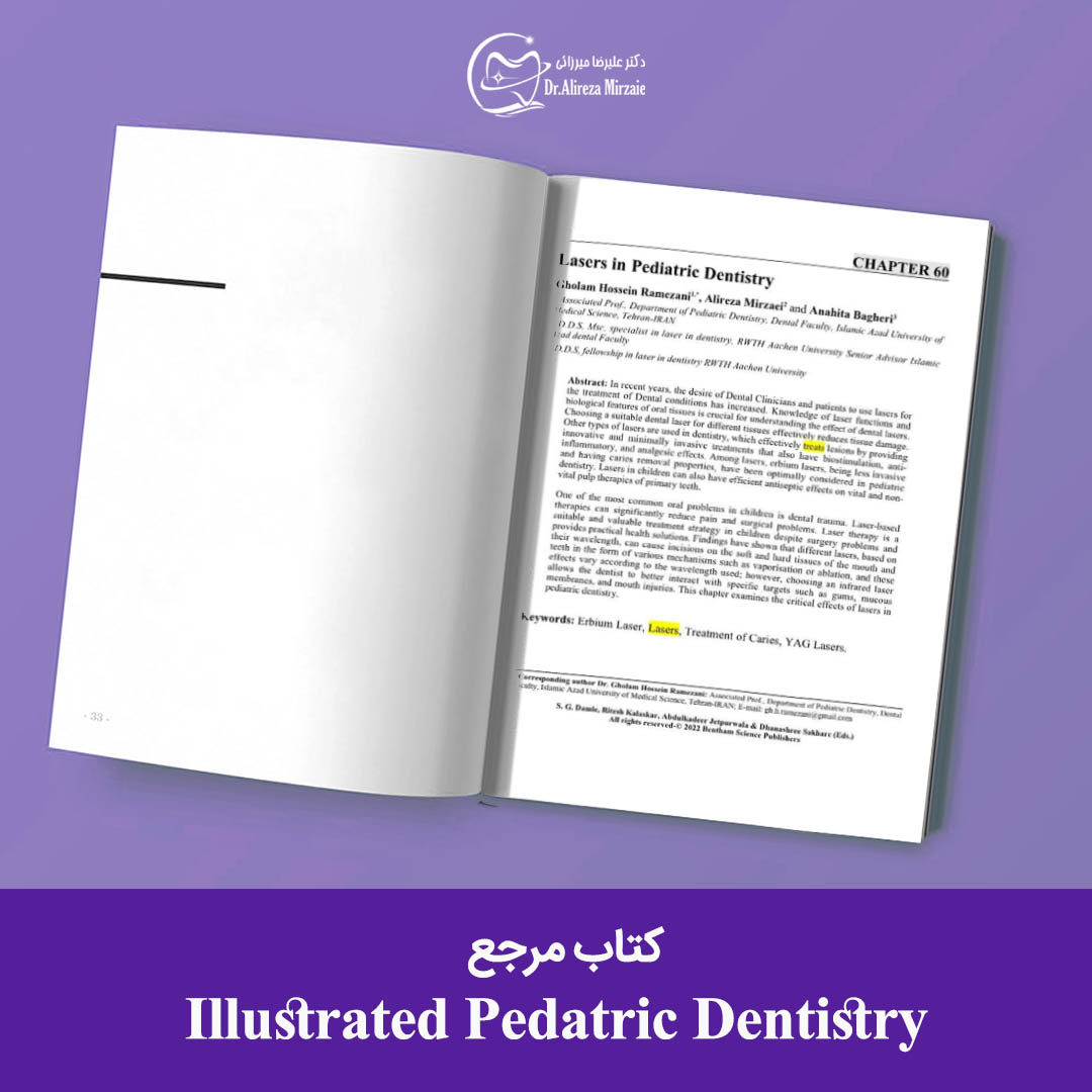 نگارش فصل کاربرد لیزر در دندانپزشکی کودکان در کتاب مرجع - دکتر علیرضا میرزائی